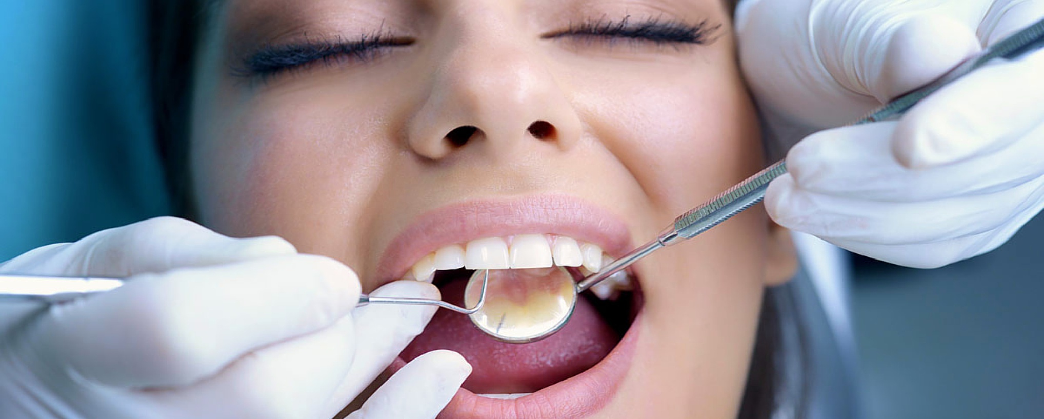 Подготовка к лечению зубов